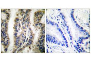 Immunohistochemistry (IHC) image for anti-Heat Shock 60kDa Protein 1 (Chaperonin) (HSPD1) (C-Term) antibody (ABIN1848614) (HSPD1 anticorps  (C-Term))