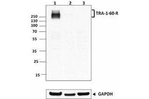 Western Blotting (WB) image for anti-TRA-1-60(R) antibody (ABIN2660534) (TRA-1-60(R) anticorps)