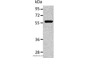Western blot analysis of K562 cell, using ALDH1A2 Polyclonal Antibody at dilution of 1:400 (ALDH1A2 anticorps)