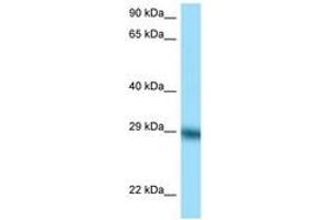 Image no. 1 for anti-Tissue Factor Pathway Inhibitor (Lipoprotein-Associated Coagulation Inhibitor) (TFPI) (C-Term) antibody (ABIN6748178) (TFPI anticorps  (C-Term))