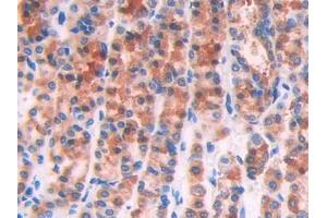 DAB staining on IHC-P; Samples: Rat Stomach Tissue (IL1R1 anticorps  (AA 119-217))