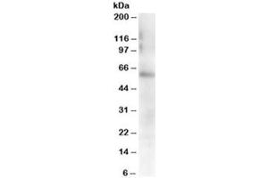 Western blot testing of mouse spleen lysate with FGR antibody at 0. (Fgr anticorps)