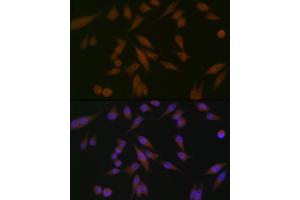 Immunofluorescence analysis of HeLa cells using P Rabbit mAb (ABIN1682842, ABIN3019312, ABIN3019313 and ABIN7101749) at dilution of 1:100 (40x lens). (PAWR anticorps)
