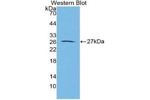 Western Blotting (WB) image for anti-Aggrecan (ACAN) (AA 2162-2316) antibody (ABIN2117831) (Aggrecan anticorps  (AA 2162-2316))