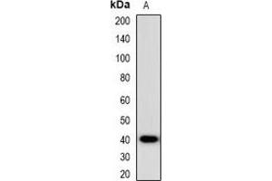 Western blot analysis of CCR5 expression in HEK293T (A) whole cell lysates. (CCR5 anticorps)