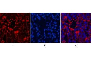 Immunofluorescence analysis of mouse lung tissue. (LC3B anticorps)