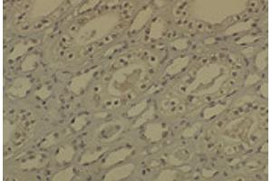 IHC analysis of DNMT1 in medullar kidney tissue sections using DNMT / DNMT1 antibody. (DNMT1 anticorps  (AA 637-650) (Atto 390))