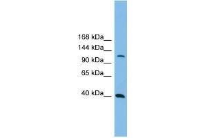 Host:  Rabbit  Target Name:  MAP3K14  Sample Tissue:  Human THP-1 Whole Cell  Antibody Dilution:  1ug/ml (MAP3K14 anticorps  (N-Term))
