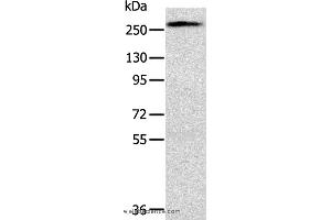 Western blot analysis of Huvec cell, using TLN1 Polyclonal Antibody at dilution of 1:200 (TLN1 anticorps)