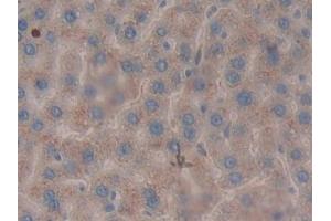 Detection of LEI in Rat Liver Tissue using Polyclonal Antibody to Leukocyte Elastase Inhibitor (LEI) (SERPINB1 anticorps  (AA 17-332))