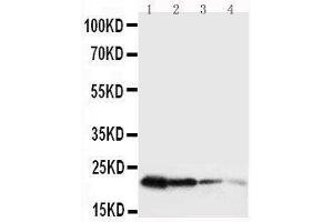 Anti-mouse Growth Hormone antibody, Western blotting Lane 1: Recombinant Mouse GH Protein 10ng Lane 2: Recombinant Mouse GH Protein 5ng Lane 3: Recombinant Mouse GH Protein 2 (Growth Hormone 1 anticorps  (AA 27-216))