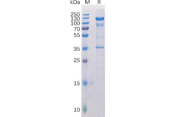 Melanoma gp100 Protein (AA 25-595) (Fc Tag)