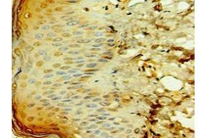 Immunohistochemistry of paraffin-embedded human skin tissue using ABIN7171674 at dilution of 1:100 (TCTN2 anticorps  (AA 420-670))
