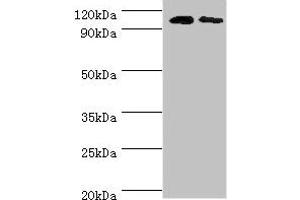 Western blot All lanes: Cytosolic 10-formyltetrahydrofolate dehydrogenase antibody at 8 μg/mL Lane 1: Mouse liver tissue Lane 2: Mouse gonad tissue Secondary Goat polyclonal to rabbit IgG at 1/10000 dilution Predicted band size: 99, 88, 100, 56 kDa Observed band size: 99 kDa (ALDH1L1 anticorps  (AA 1-250))
