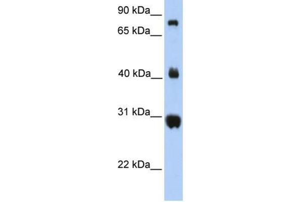 FIBCD1 anticorps  (C-Term)