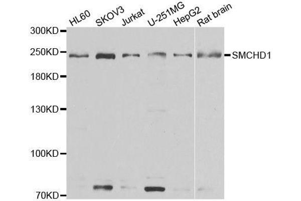 SMCHD1 anticorps  (AA 1756-2005)