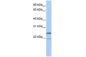 BTF3L3 antibody used at 1 ug/ml to detect target protein. (BTF3P13 anticorps  (Middle Region))