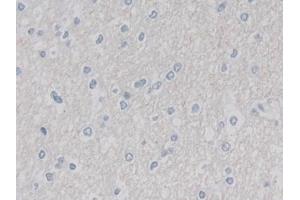 Detection of CUL9 in Human Cerebrum Tissue using Polyclonal Antibody to Cullin 9 (CUL9) (CUL9 anticorps  (AA 1144-1322))