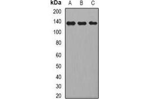 Western blot analysis of CD22 expression in HepG2 (A), Raji (B), mouse liver (C) whole cell lysates. (CD22 anticorps)