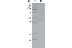 Human MRG-Nanodisc, Flag Tag on SDS-PAGE (MRGPRX2 Protéine)