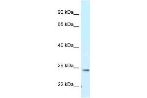 TMEM106B anticorps  (C-Term)