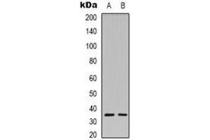 Western blot analysis of Caspase 3 p12 expression in Hela (A), MCF7 (B) whole cell lysates. (Caspase 3 p12 anticorps)