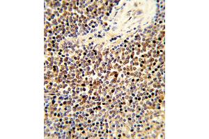 Formalin-fixed and paraffin-embedded human spleen tissue reacted with CYP24A1 Antibody (C-term), which was peroxidase-conjugated to the secondary antibody, followed by DAB staining. (CYP24A1 anticorps  (C-Term))