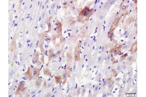 Paraformaldehyde-fixed, paraffin embedded rat heart, Antigen retrieval by boiling in sodium citrate buffer (pH6. (Rab3a+Rab3b+Rab3c+Rab3d (AA 101-150) anticorps)