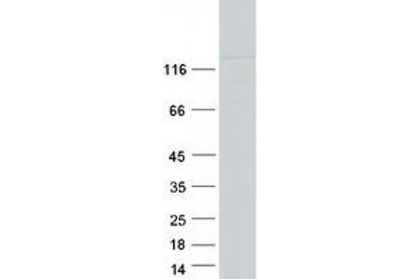 Hairless Protein (HR) (Transcript Variant 2) (Myc-DYKDDDDK Tag)