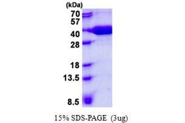 VBP1 Protein (His tag)