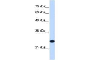 Western Blotting (WB) image for anti-Transmembrane Protein 109 (TMEM109) antibody (ABIN2463292) (TMEM109 anticorps)