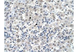 CDR2 antibody was used for immunohistochemistry at a concentration of 4-8 ug/ml to stain Hepatocytes (arrows) in Human Liver. (CDR2 anticorps  (N-Term))