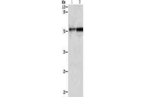 Western Blotting (WB) image for anti-Caspase 2, Apoptosis-Related Cysteine Peptidase (CASP2) antibody (ABIN2427573) (Caspase 2 anticorps)