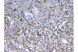 IHC analysis of Neurocan using anti-Neurocan antibody . (Neurocan anticorps)