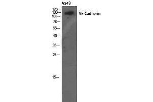 Western Blotting (WB) image for anti-Cadherin 5 (CDH5) (Ser225) antibody (ABIN3187462) (Cadherin 5 anticorps  (Ser225))