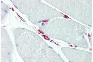 Human Skeletal Muscle: Formalin-Fixed, Paraffin-Embedded (FFPE) (CD34 anticorps  (AA 366-382))