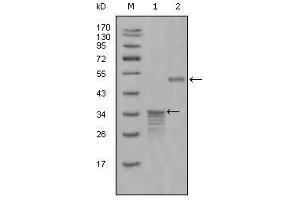 Western Blot showing Mammaglobin-1 antibody used against full-length GST- Mammaglobin-1 (1) and full-length MBP- Mammaglobin-1 (aa1-193) recombinant protein (2). (Mammaglobin A anticorps  (AA 1-193))