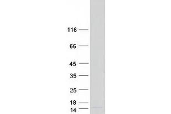 Otospiralin Protein (OTOS) (Myc-DYKDDDDK Tag)