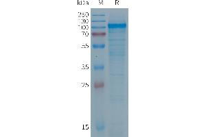 Human PTGFRN Protein, His Tag on SDS-PAGE under reducing condition. (PTGFRN Protein (AA 26-830) (His tag))