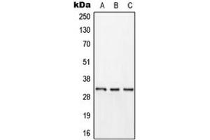 Western blot analysis of Kallikrein 11 expression in HEK293T (A), HepG2 (B), rat brain (C) whole cell lysates. (Kallikrein 11 anticorps  (Center))