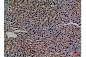 Immunohistochemical analysis of paraffin-embedded rat-liver, antibody was diluted at 1:100. (Transferrin anticorps  (C-Term))