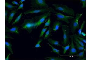 Immunofluorescence of purified MaxPab antibody to ANKMY1 on HeLa cell. (ANKMY1 anticorps  (AA 1-720))