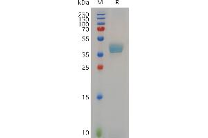Cynomolgus Protein, hFc Tag on SDS-PAGE under reducing condition. (CCR8 Protein (AA 1-35) (Fc Tag))