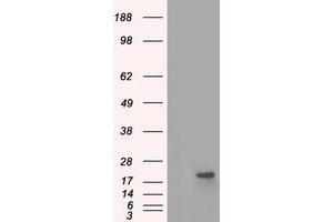 Image no. 2 for anti-Crystallin, alpha B (CRYAB) antibody (ABIN1497646) (CRYAB anticorps)