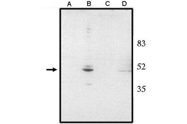 VSX2 anticorps  (N-Term)