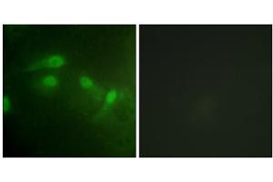 Immunofluorescence analysis of HeLa cells, using MDM2 (Phospho-Ser186+Ser188) antibody. (MDM2 anticorps  (pSer186, pSer188))