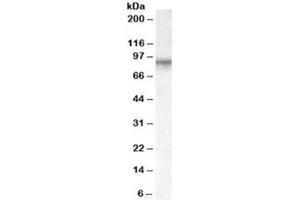 Western blot testing of human placenta lysate with Factor XIIIa antibody at 0. (F13A1 anticorps)