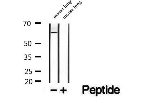 Seladin 1 anticorps  (N-Term)