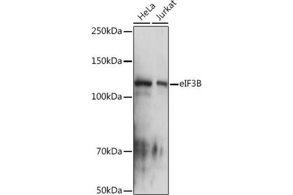 EIF3B anticorps