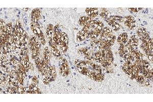 Immunohistochemistry (IHC) image for anti-Parathyroid Hormone (PTH) antibody (ABIN7538931) (PTH anticorps)